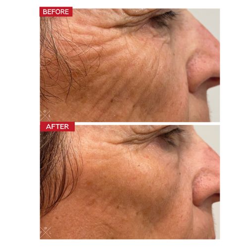Dr Levy Contour Pro Face Age Reversing - Image 2